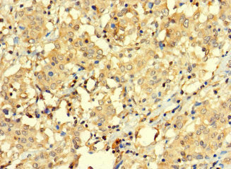 BAGE3 Antibody