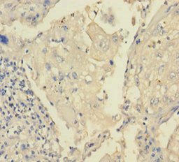 TRPM8 Antibody