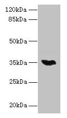 LYSMD3 Antibody