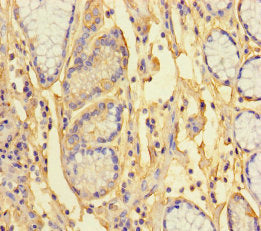 ANKRD33 Antibody