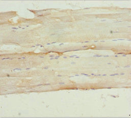NPHP3 Antibody