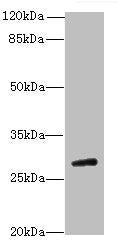 TBC1D26 Antibody