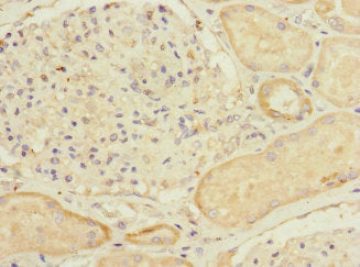 MYLK4 Antibody