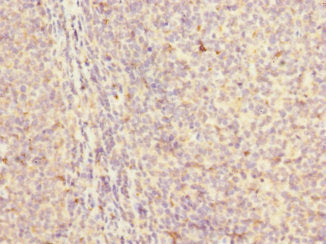 MYLK4 Antibody