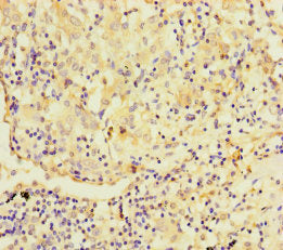 TMPRSS11B Antibody