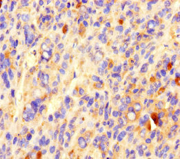 CCDC84 Antibody