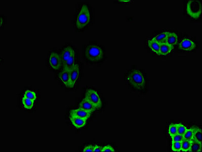 SLC51B Antibody
