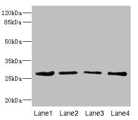 DCXR Antibody