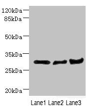 DCXR Antibody