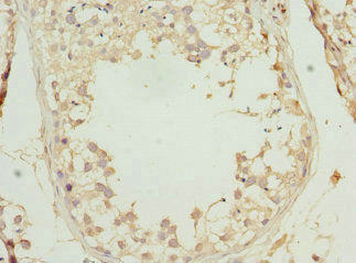 PRICKLE2 Antibody