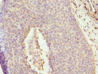 DAAM2 Antibody