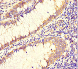 DAAM2 Antibody