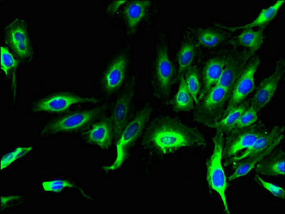 LHFPL1 Antibody