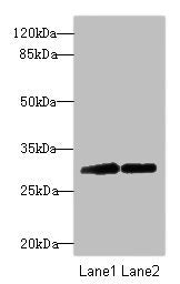 TRIM69 Antibody