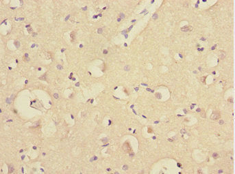 TRIM69 Antibody
