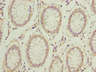 COMMD2 Antibody