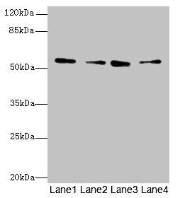 ERO1B Antibody