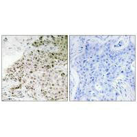 TAF13 Antibody