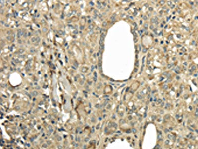 UBE2B Antibody