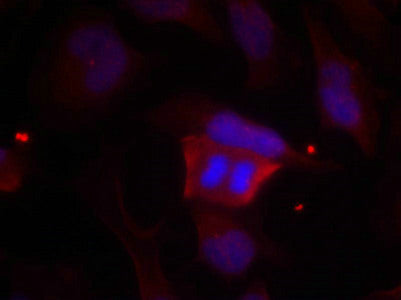 Phospho-PPP1R1B (Thr75) Antibody