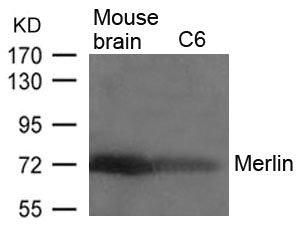 NF2 (Ab-518) Antibody
