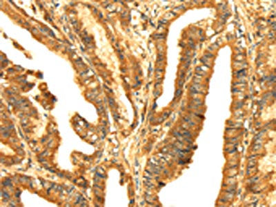 RLN1 Antibody