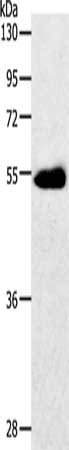 SLC2A3 Antibody