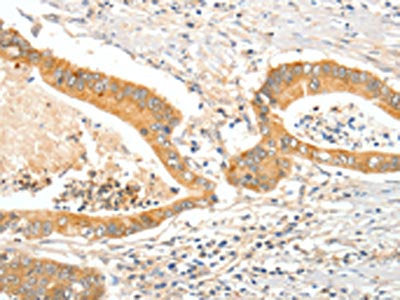 APOB Antibody