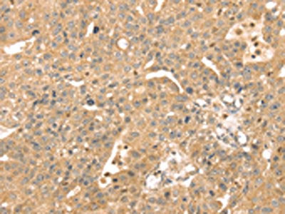 ATOX1 Antibody
