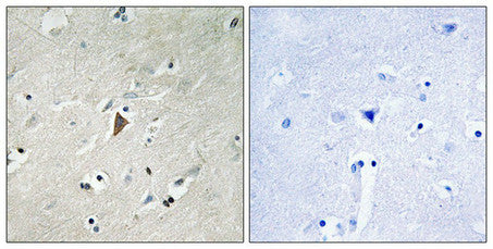 Phospho-PDPK1 (Tyr9) Antibody