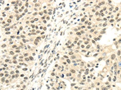 TBL1XR1 Antibody