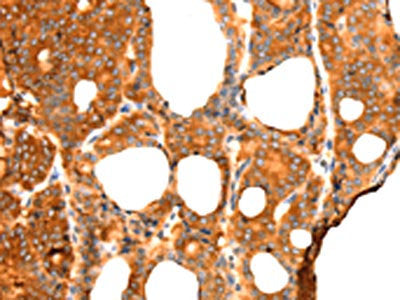 RGS5 Antibody