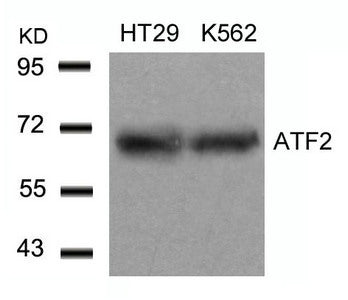 ATF2 (Ab-71 or 53) Antibody