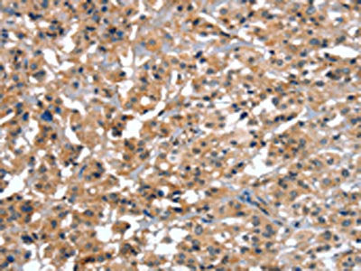 CTBP1 Antibody