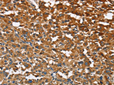 ATP1B2 Antibody