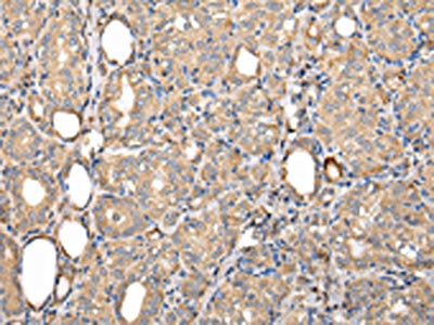 SERPINA7 Antibody
