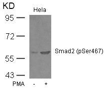 Phospho-SMAD2 (Ser467) Antibody