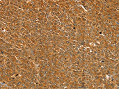 ST18 Antibody