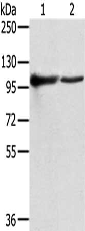 TPX2 Antibody
