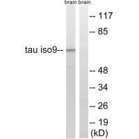 MAPT (Ab-534/217) Antibody