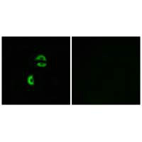 LDLRAD3 Antibody