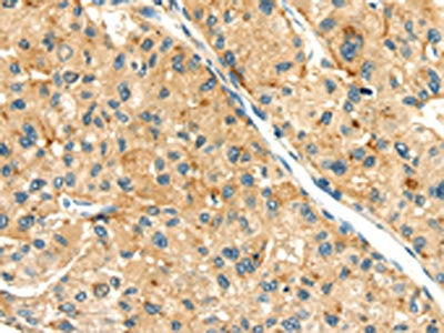 SEMA4C Antibody