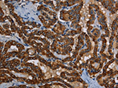 PIDD1 Antibody