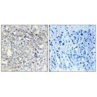 SERPIND1 Antibody