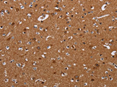 LUM Antibody