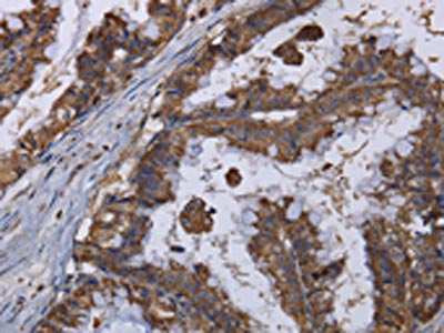 MT3 Antibody