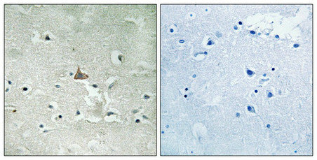 Phospho-NTRK2 (Tyr706/Tyr707) Antibody