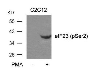 Phospho-EIF2S2 (Ser2) Antibody