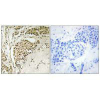 NOM1 Antibody