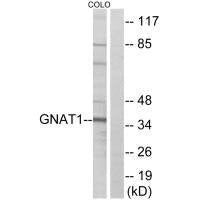 GNAT1 Antibody
